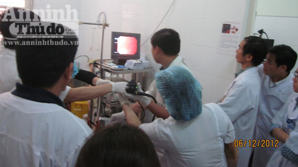 Cụ bà 77 tuổi bị dị vật "kết tinh" dài 6 cm mắc trong tá tràng ảnh 1