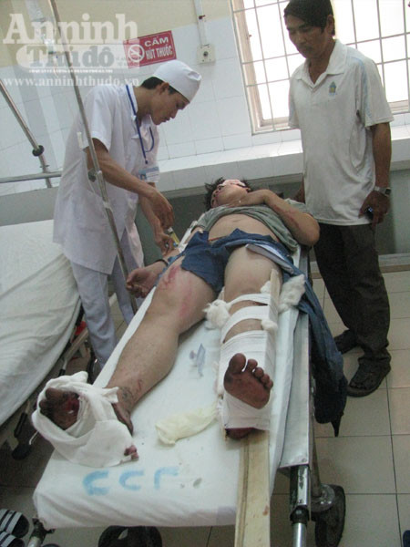 Xe bồn "đấu đầu" với xe khách, hàng chục hành khách hoảng loạn ảnh 8