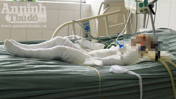 Vụ án tưới xăng, phóng hỏa ở Hải Phòng: Nạn nhân thứ 3 tử vong ảnh 1