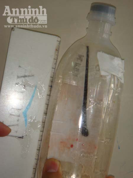 Phát hiện con vắt dài 10cm trong khí quản một bệnh nhân ảnh 1