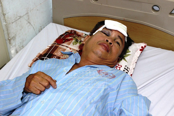 “Cẩu tặc” chém công an xã nhập viện ảnh 1