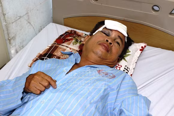 “Cẩu tặc” chém công an xã nhập viện ảnh 1