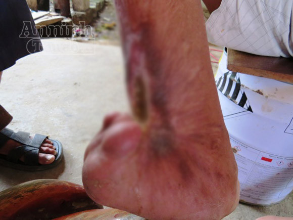 Kinh hoàng vụ thảm sát ở Liên Khê: Chuyện bây giờ mới kể ảnh 3