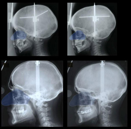 Vì sao mũi đàn ông lớn hơn phụ nữ? ảnh 1
