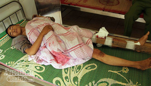 Đấu súng truy bắt toán người buôn ma túy, một chiến sỹ công an hy sinh ảnh 3