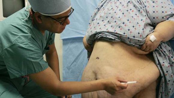 Điều trị bệnh tiểu đường: Tự bỏ đói ảnh 1