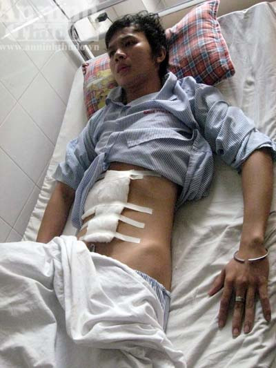 Một thanh niên bị côn đồ đâm thủng bụng ảnh 1