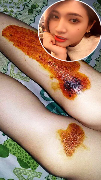 Hàng loạt sao Việt từng trầy da xước mặt vì bị cướp giật ở TP.HCM ảnh 1