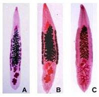 Hốt hoảng phát hiện giun, sán lồm cồm dưới da sau khi ăn hải sản tươi sống ảnh 1