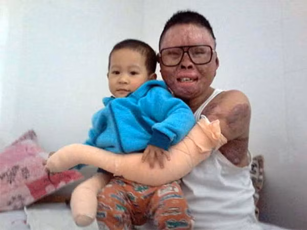 Chiến sỹ duy nhất sống sót trong vụ rơi máy bay tại Hòa Lạc giờ ra sao? ảnh 1