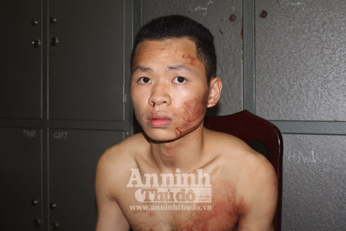  Tận mắt chứng kiến hiện trường vụ 9x sát hại tài xế taxi trên đường Võ Chí Công ảnh 9