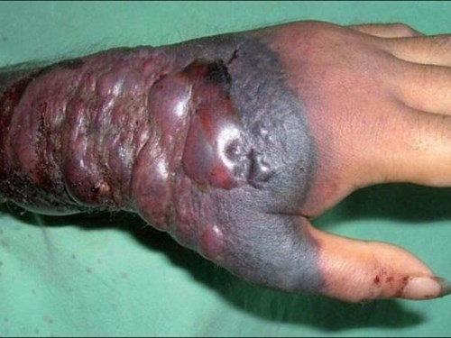 Audio 14-4-2015: Ngộ độc thực phẩm tại dự án Formosa và việc Philippines “tố” Trung Quốc hủy hoại môi trường biển Đông ảnh 5