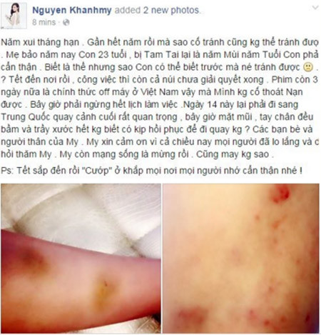 Hàng loạt sao Việt từng trầy da xước mặt vì bị cướp giật ở TP.HCM ảnh 14