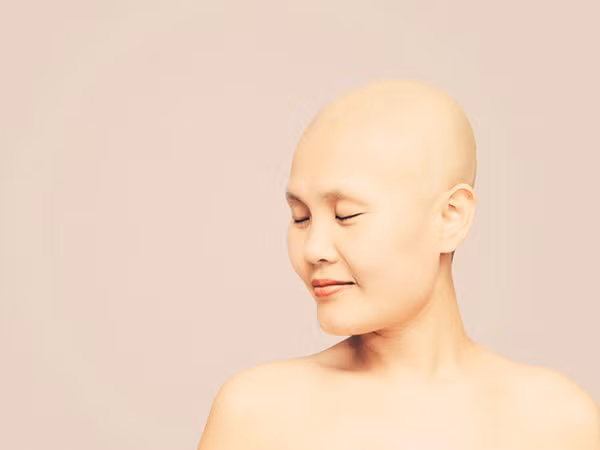 Thương Sobey - “người hùng thắp lửa” cho hàng triệu phụ nữ ung thư vú, đã yên nghỉ ảnh 7