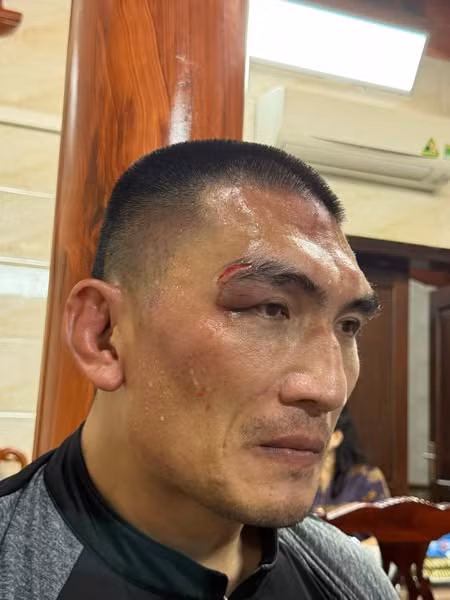 Hiếu "khổng lồ" đổ máu khi đấu đô vật Belarus (Ảnh: Đào Hồng Sơn) Hiếu "khổng lồ" đổ máu khi đấu đô vật Belarus (Ảnh: Đào Hồng Sơn)