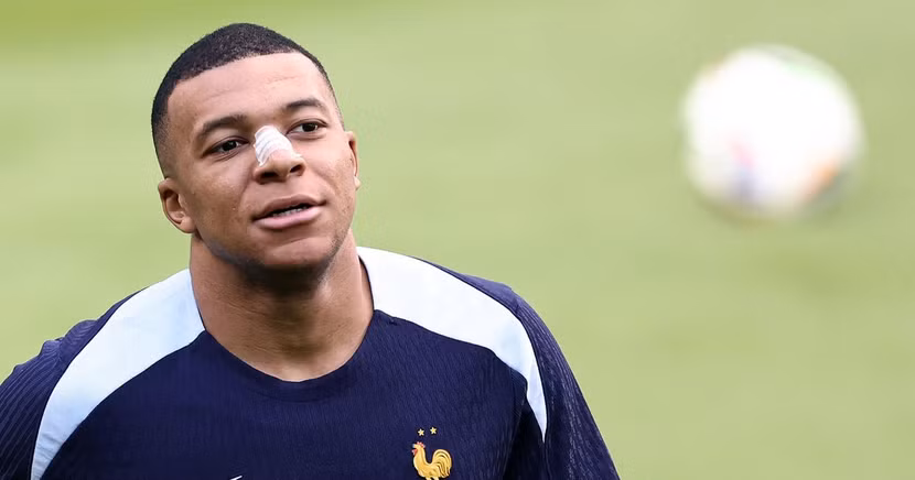 Hình ảnh mới nhất của Mbappe sau chấn thương vùng mũi Hình ảnh mới nhất của Mbappe sau chấn thương vùng mũi
