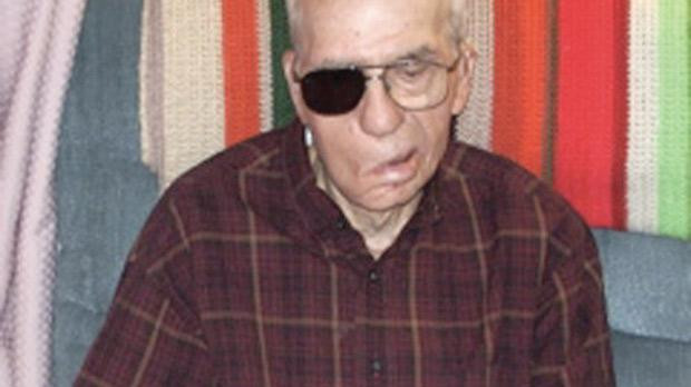 Thọ trăm tuổi với mảnh đạn "găm" trong đầu ảnh 1