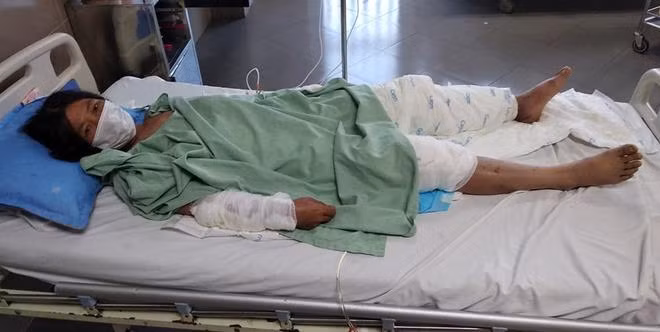 Bà Hường đang được cấp cứu tại bệnh viện đa khoa tỉnh Lạng Sơn