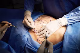 Mới nhất: Người phẫu thuật thay đổi ngoại hình được xem xét đổi tên nếu có căn cứ hợp lý