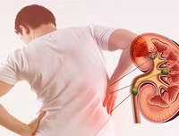 [ẢNH] Những dấu hiệu cảnh báo sớm bệnh sỏi thận bạn nên biết