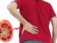 [ẢNH] Những dấu hiệu cảnh báo sớm bệnh sỏi thận bạn nên biết