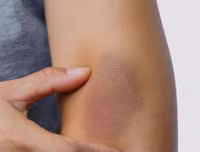 [ẢNH] 12 dấu hiệu bất thường trên cơ thể 