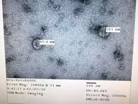 [ẢNH] Những phát hiện khoa học quan trọng của các nước về virus corona