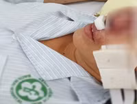 [ẢNH] Những điều cần biết về Whitmore- Bệnh truyền nhiễm có nguy cơ gây tử vong
