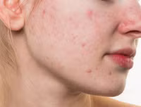 [ẢNH] Cảnh báo những căn bệnh dễ mắc phải khi trời nồm ẩm và cách phòng tránh