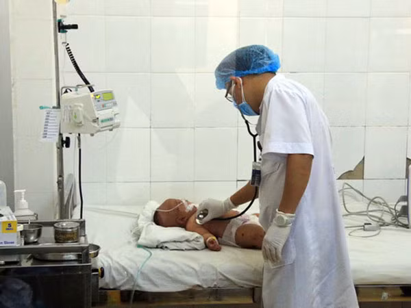 Cách phòng bệnh viêm não mô cầu ảnh 1
