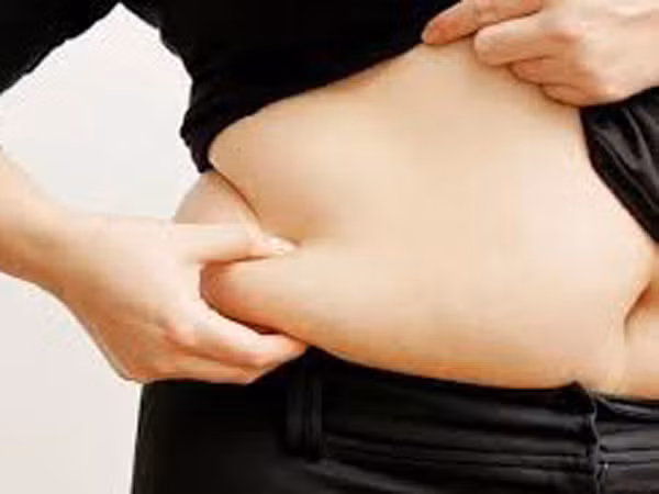 Béo phì dễ bị ung thư tuyến tụy ảnh 1