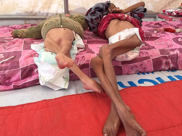 Nghẹn lòng trước số phận những em bé ở Mosul, Iraq ảnh 1