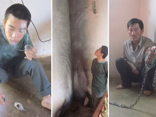 Một cậu bé 3 lần đốt nhà, 4 lần điện giật ảnh 1