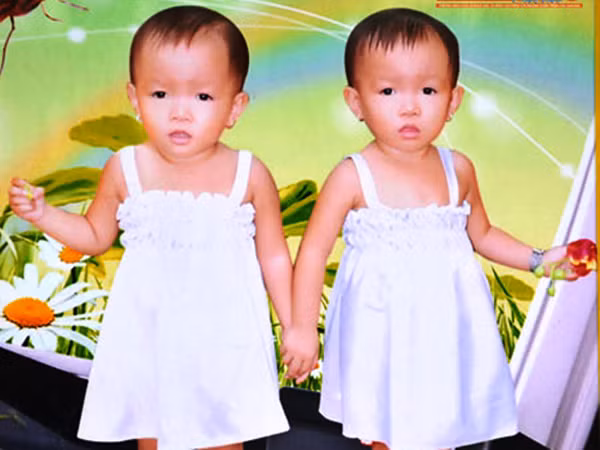 Bí ẩn khó lý giải ở vùng đất có 50 cặp vợ chồng sinh đôi ảnh 2