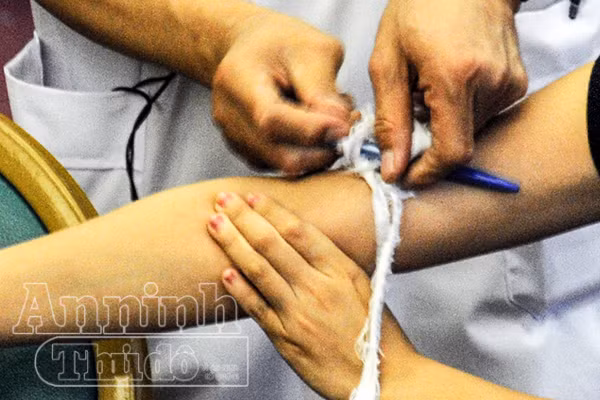 Chi tiết ảnh quy trình sơ cứu vết thương mạch máu do tôn cắt, hoặt vật nhọn cứa ảnh 8