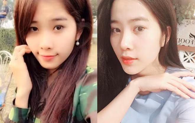 Loạt ảnh "tố" Nam Em rõ ràng đẹp lên nhờ "dao kéo" ảnh 6